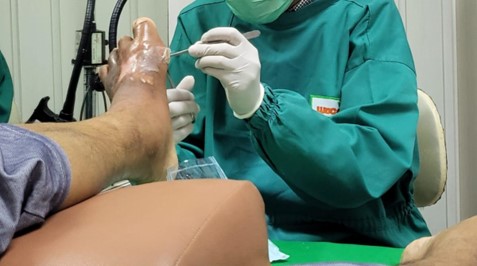 ANTT (Aseptic Non-Touch Technique)