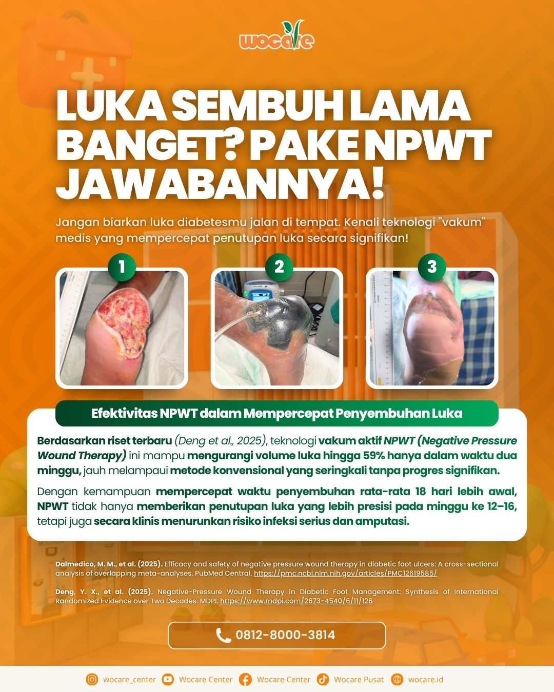 Solusi Cerdas Penyembuhan Luka Kronis: Mengenal NPWT di Wocare